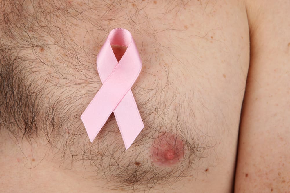 kanker payudara pada pria