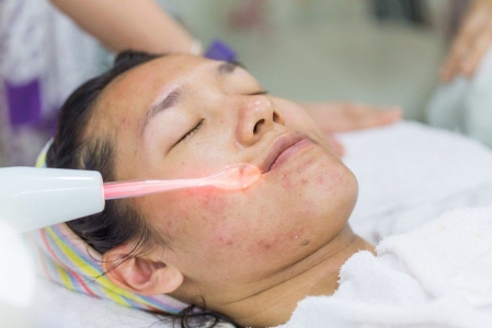 8 Efek Samping yang Mungkin Terjadi Akibat Facial