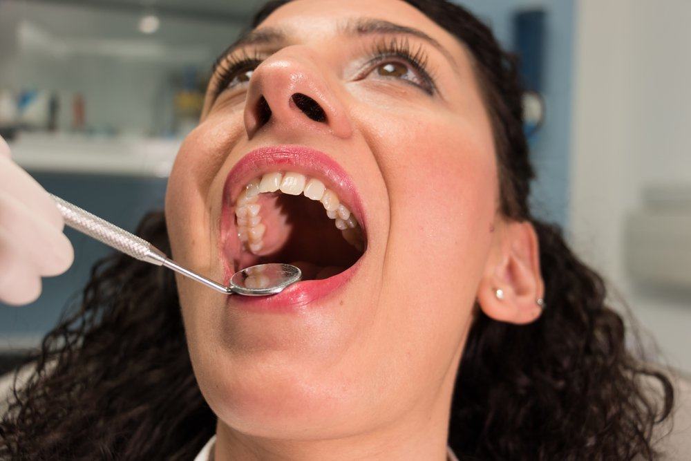 5 Fakta tentang Gigi Bungsu yang Penting Anda Ketahui