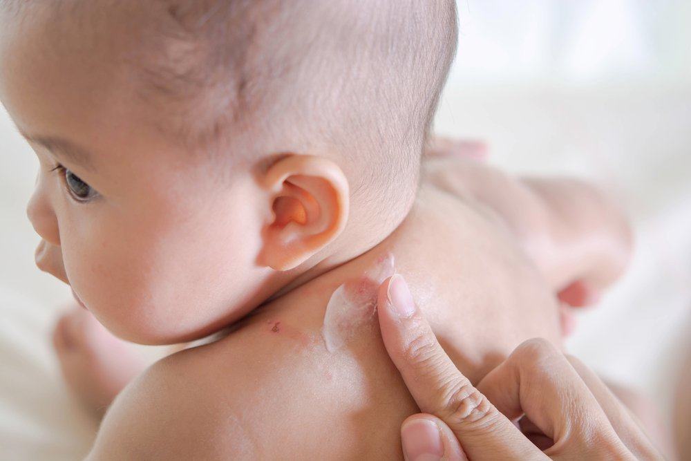 4 Tips Melindungi Bayi Anda dari Gigitan Nyamuk