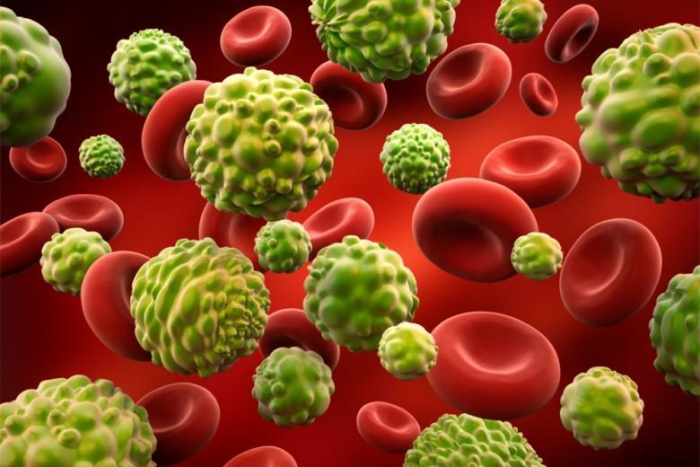 jenis kanker darah pada anak