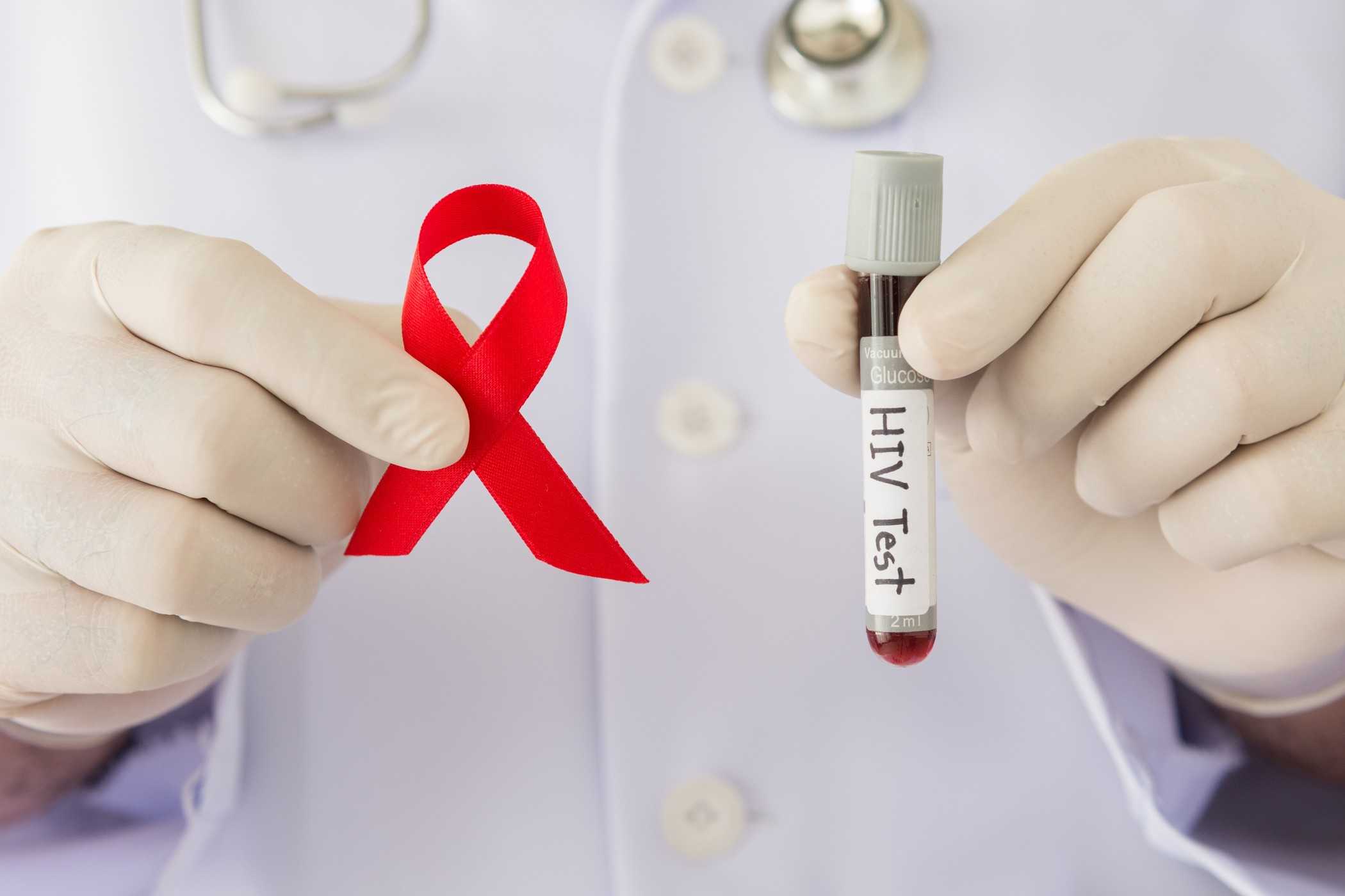 6 Cara Anda Bisa Tertular Hiv Hello Sehat