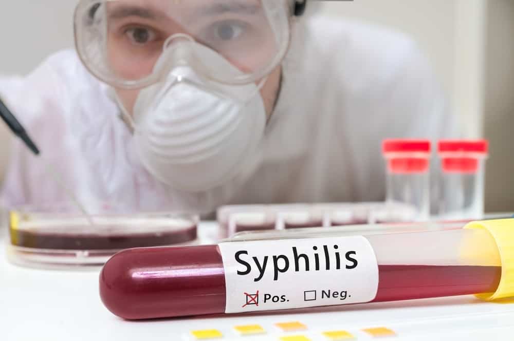 Berbagai Penyebab Sifilis yang Patut Anda Waspadai