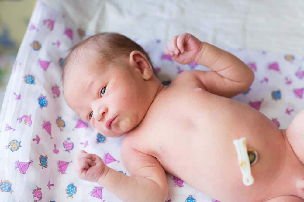 Pusar Bodong pada Bayi, Apa Penyebabnya dan Perlukah Prosedur Operasi?