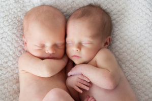 komplikasi hamil bayi kembar