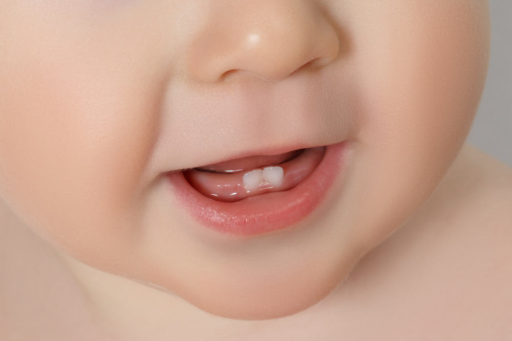 Apakah Benar Bayi Akan Demam Saat Tumbuh Gigi?