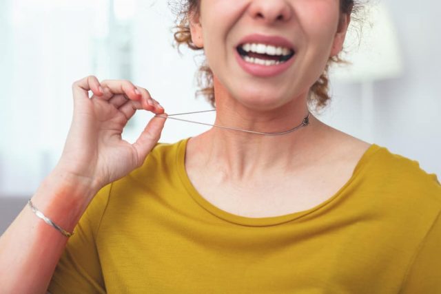 Alergi Logam Perhiasan: Gejala dan Cara Mengatasinya Tanpa Obat