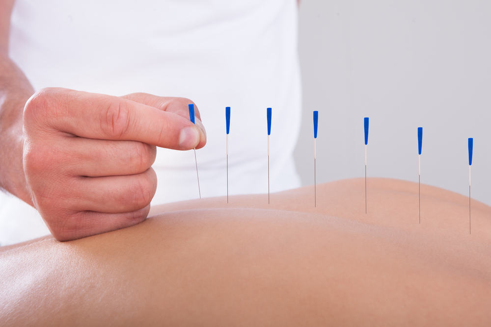 Apakah Akupunktur Bisa Meredakan Nyeri Pada Pasien Kanker?