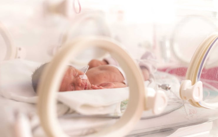 risiko melahirkan bayi prematur