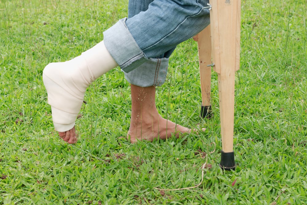 Patah Tulang Kaki dan Tungkai