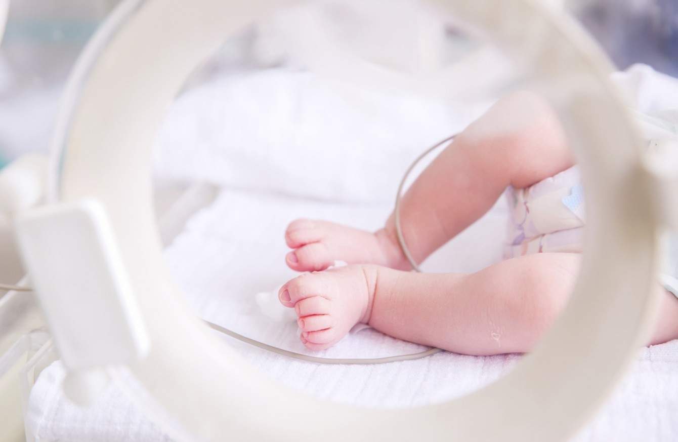 Cara Perawatan Bayi Prematur Di Rumah