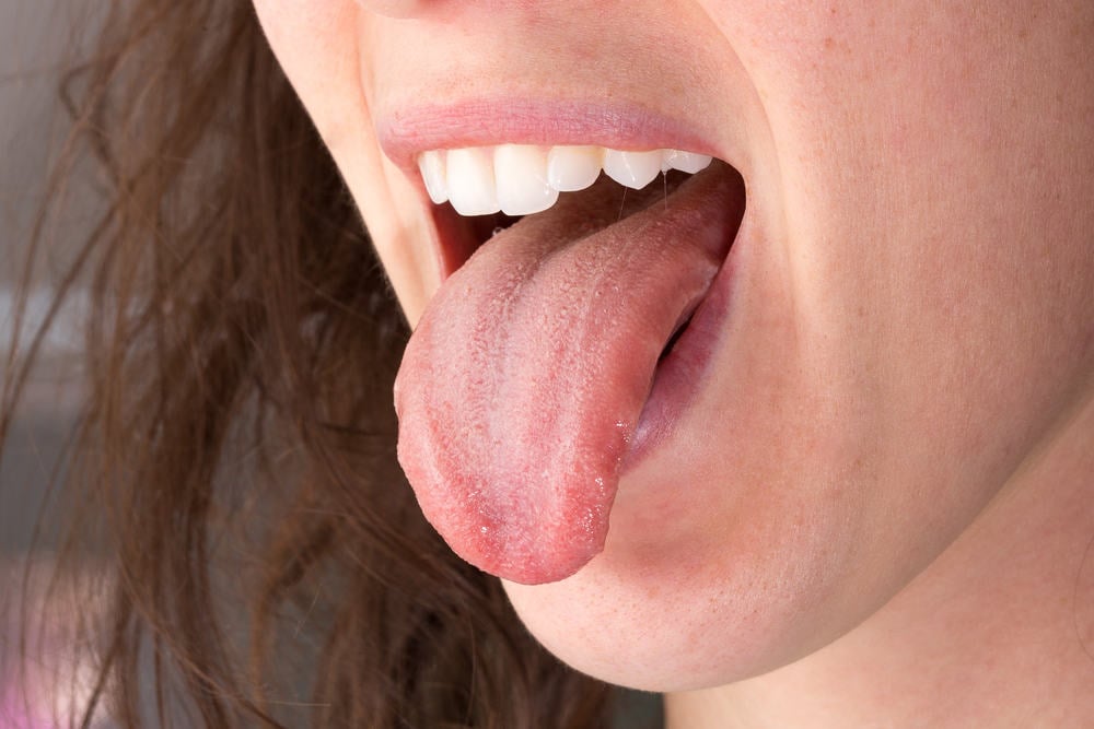 Demam tinggi lidah kering mulut terasa pahit dan selera makan hilang merupakan gejala penyakit