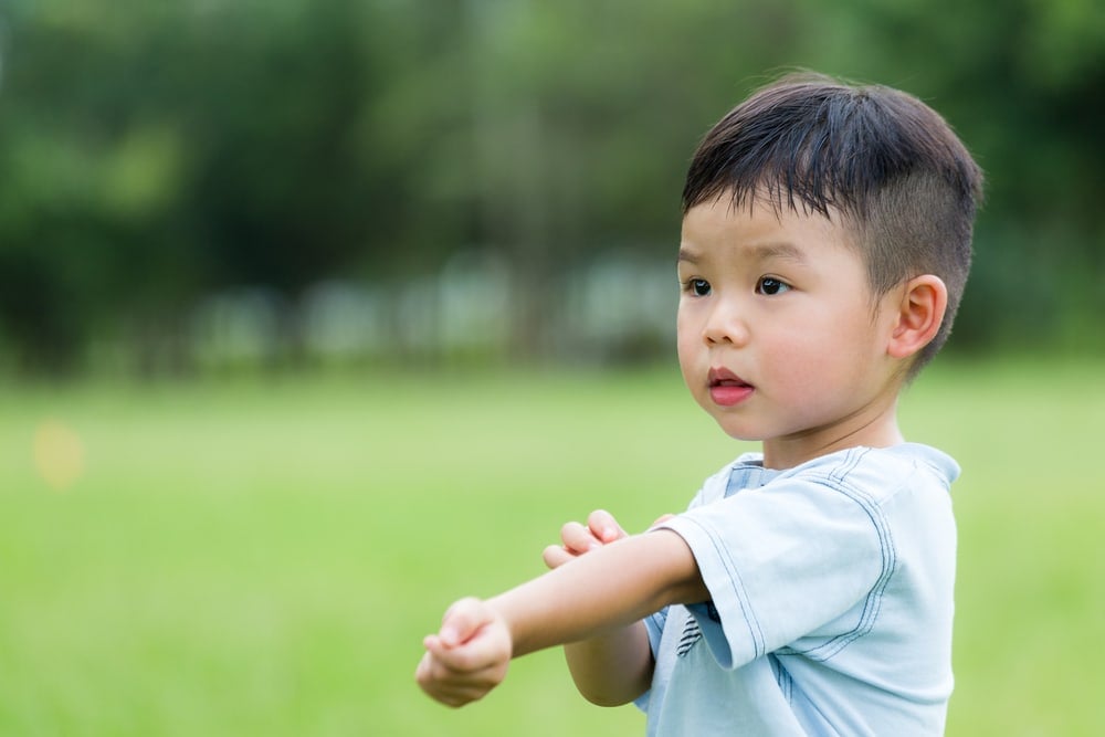 12 Penyakit Kulit pada Anak yang Paling Sering Muncul