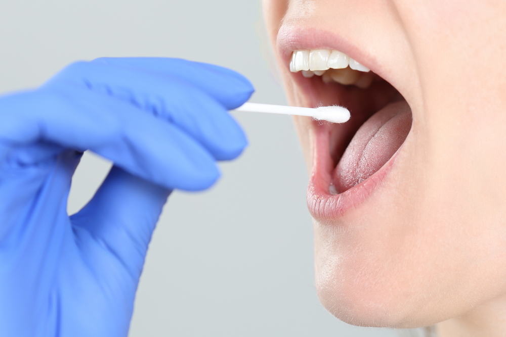 7 Penyakit yang Menyerang Kelenjar Ludah di Mulut Anda