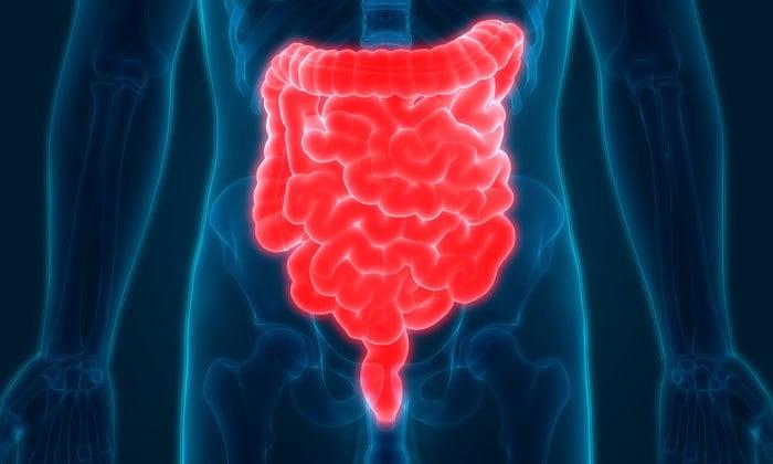 Pseudomembranous Colitis