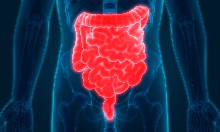 Pseudomembranous Colitis