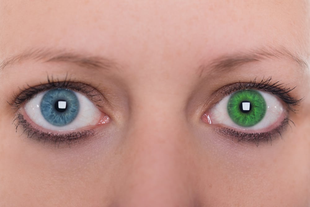 Heterochromia, Saat Kedua Mata Anda Berbeda Warna