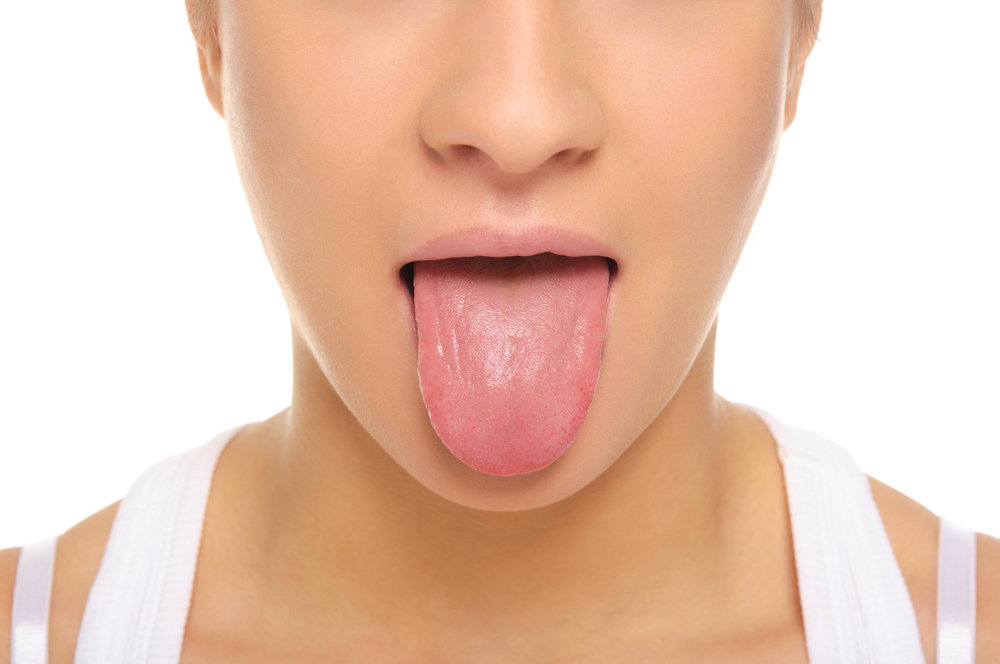 Pilihan Obat Alami Oral Thrush atau Infeksi Jamur di Mulut