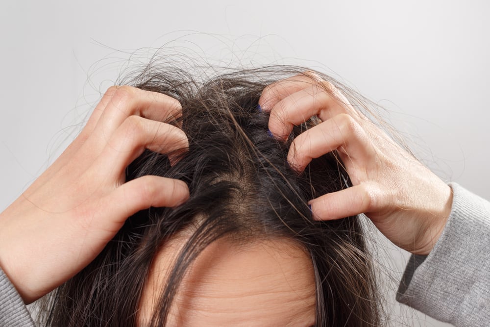 manfaat alpukat untuk rambut dan kulit kepala eksim