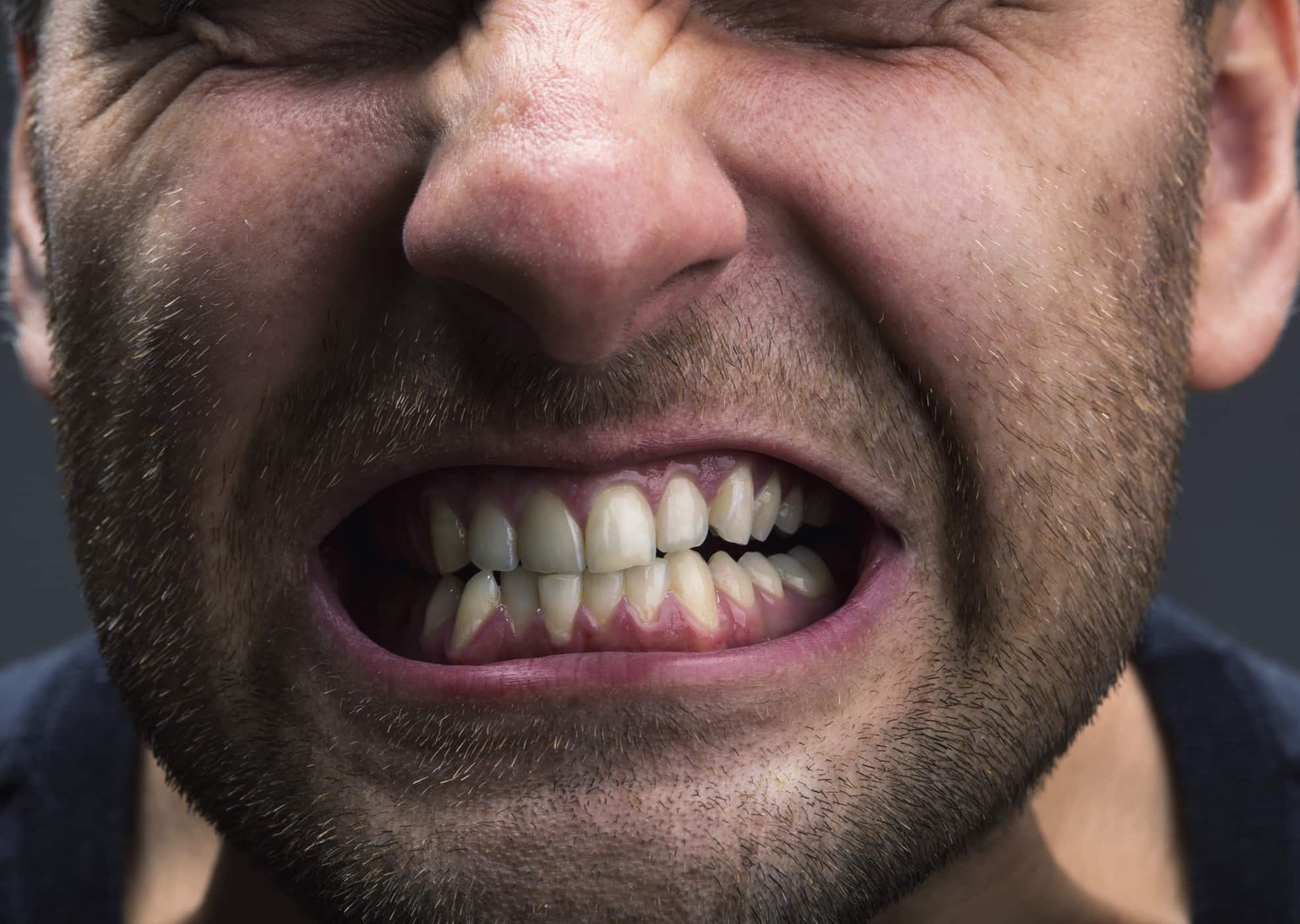 3 Gangguan Pada Mulut yang Disebabkan Oleh Stres