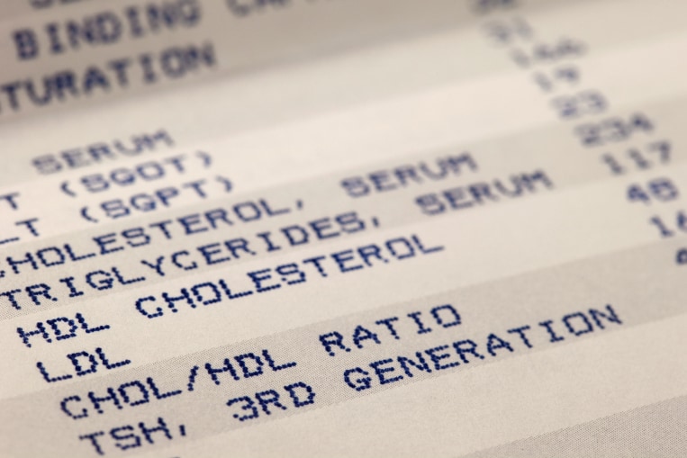 Kelebihan Kolesterol “Baik” Juga Bisa Menjadi Penyebab Kematian Dini