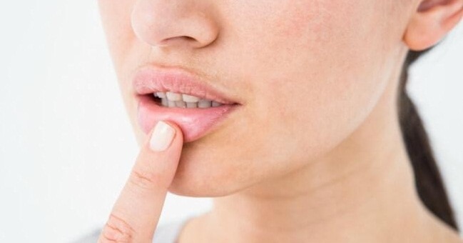5 Penyebab Mulut Kering, dari yang Ringan Hingga Berbahaya