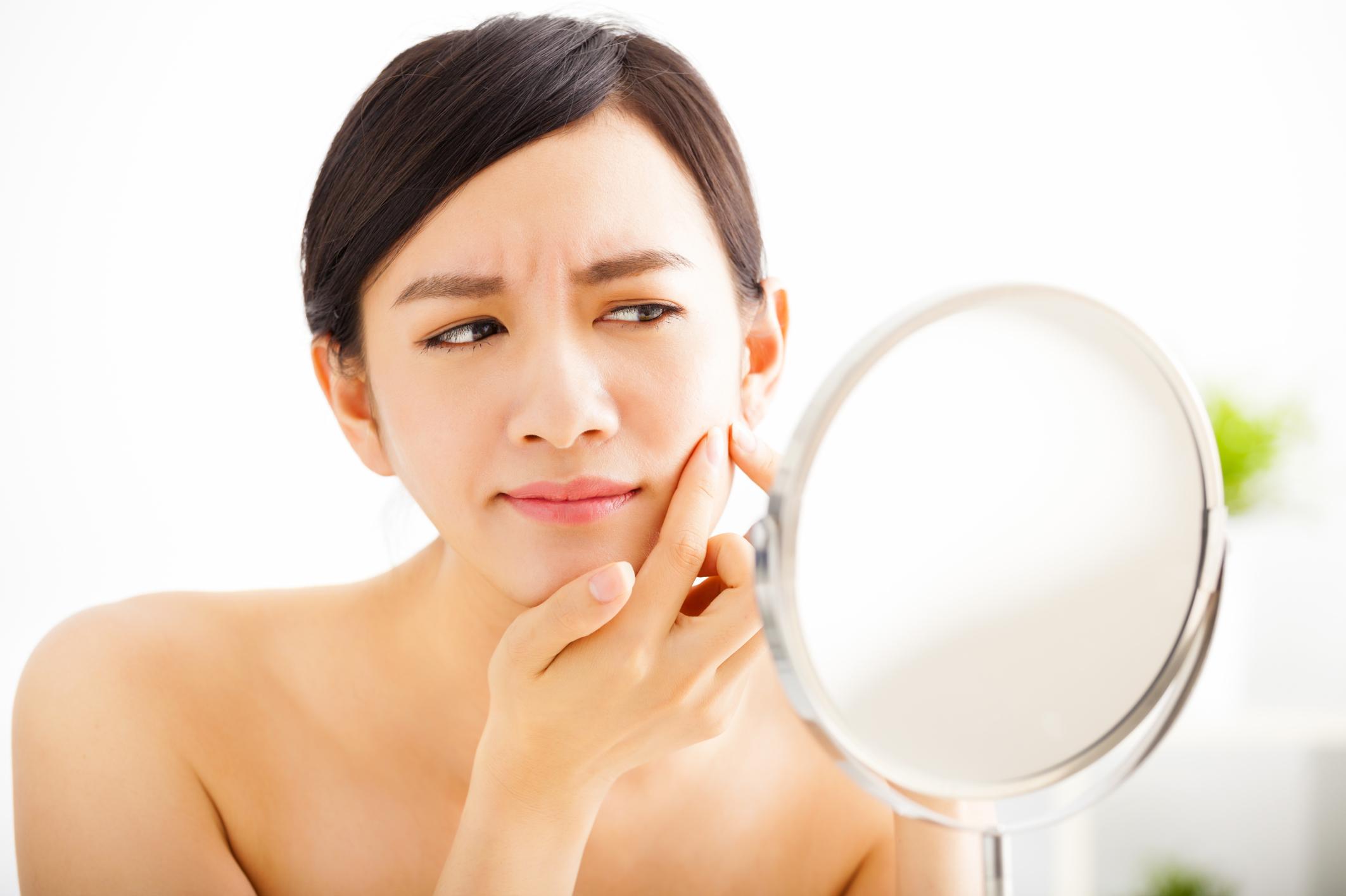 Apakah Obat Jerawat Herbal Lebih Ampuh Dibanding Obat Kimia?
