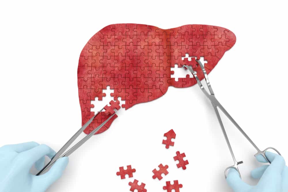 Hati (Liver) Manusia Ternyata Bisa Tumbuh Lagi Seperti Ekor Cicak