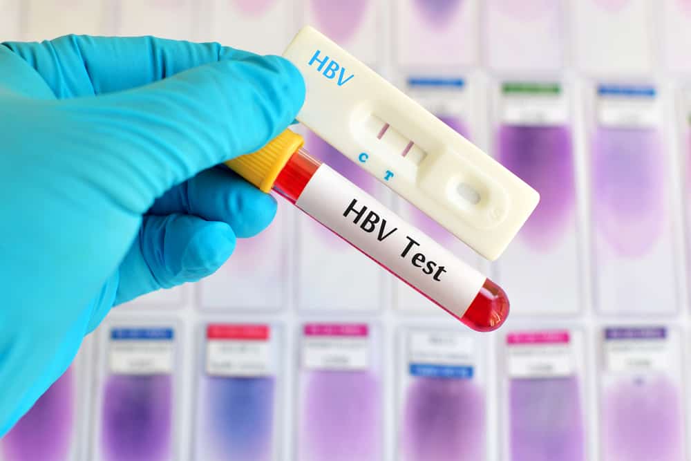 Tes darah setelah mengetahui gejala hepatitis B