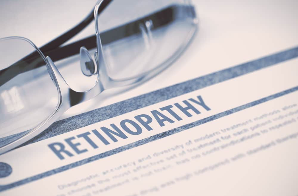 Retinopati Hipertensi, Dapat Menimbulkan Gangguan Penglihatan Hingga Kebutaan