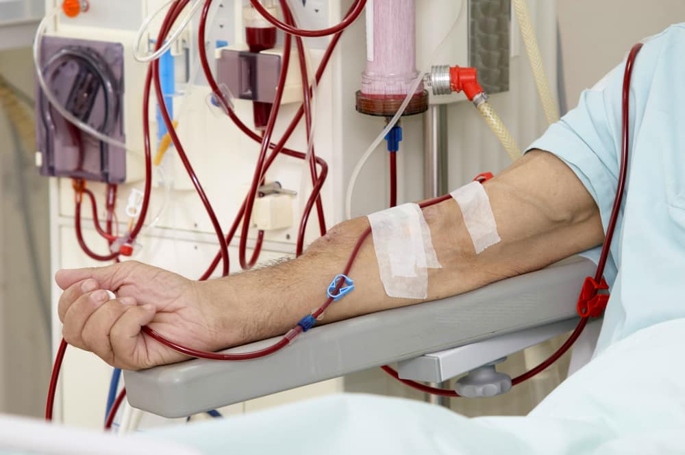 Perawatan Pasien Cuci Darah yang Rentan Tertular COVID-19