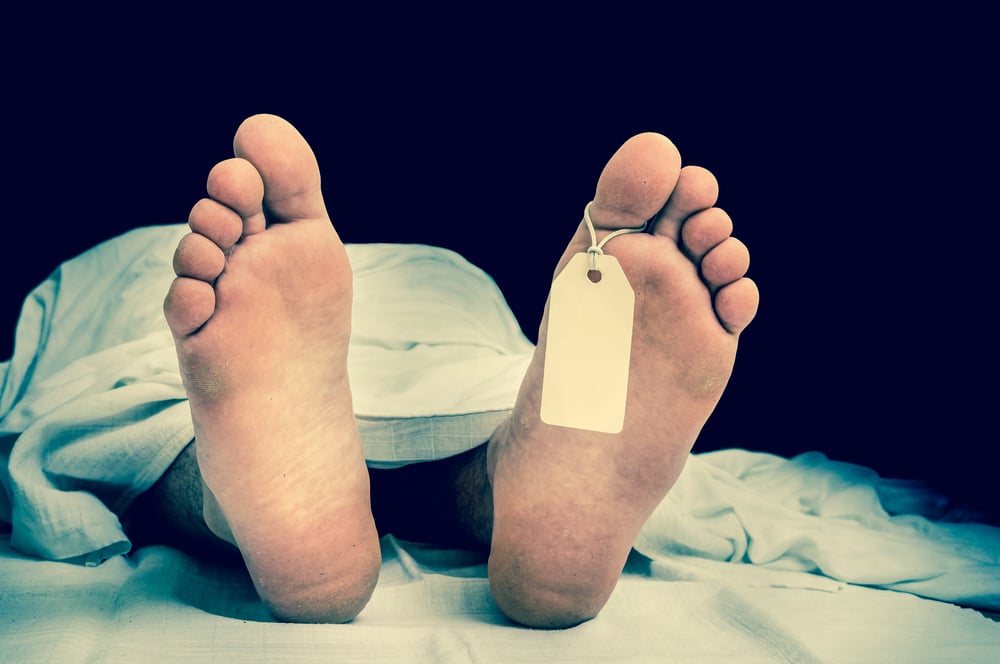Mengenal Proses Autopsi Mayat untuk Mengetahui Penyebab Kematian