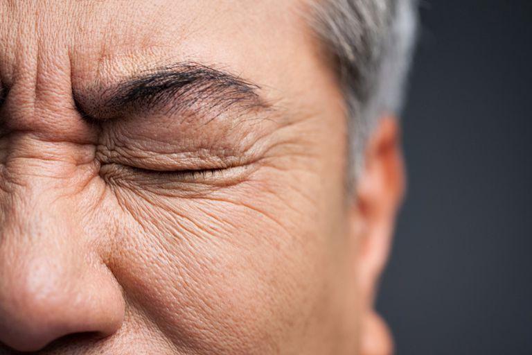 Mengenal Trikiasis: Ketika Bulu Mata Tumbuh ke Dalam, ke Arah Bola Mata