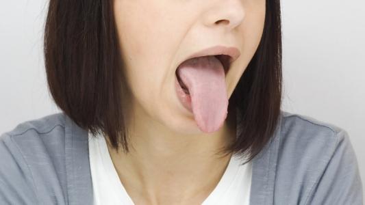 Mulut Terasa Asam? Ini Penyebab dan Cara Mengatasinya