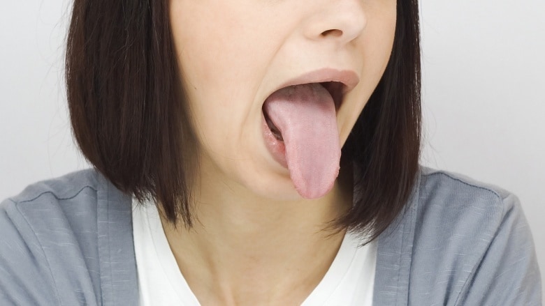 Mulut Terasa Asam Padahal Anda Bukan Perokok? Ini Sebab dan Cara Mengatasinya