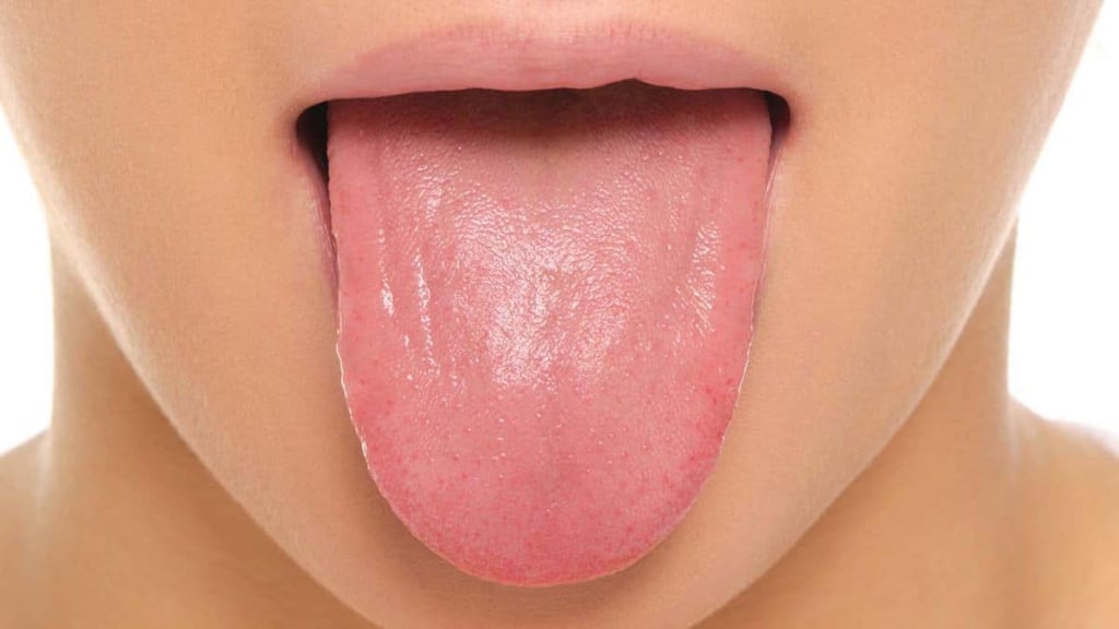 bentuk lidah