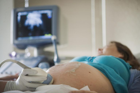 Mengenal Fetal Nonstress Test (NST), Tes Saat Hamil untuk Cek Kesehatan Bayi