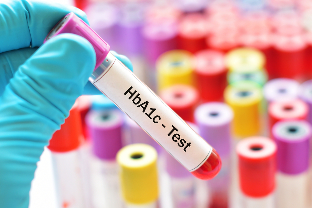 Tes HbA1c (Hemoglobin A1c) untuk Pasien Diabetes