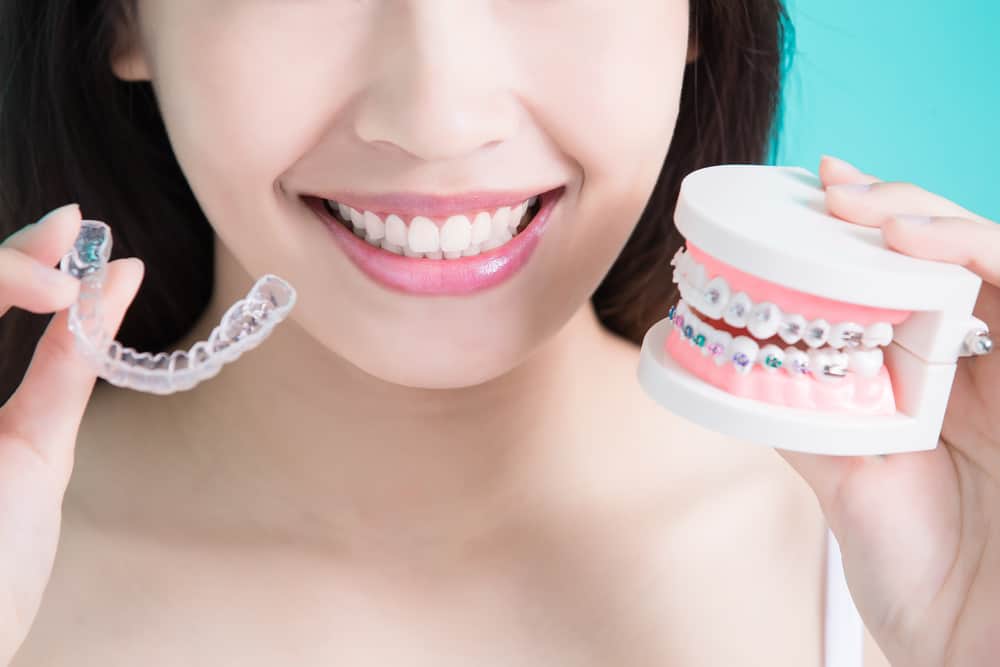 cara merawat gigi behel, cara merawat kawat gigi, perawatan gigi behel