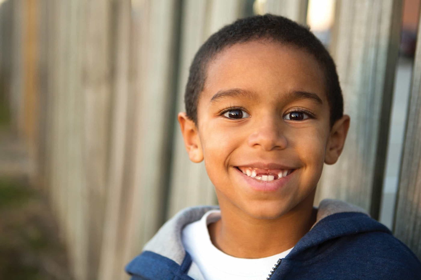 Mulai Kapan Gigi Susu Anak Copot? Apakah Pasti Akan Copot Semua?