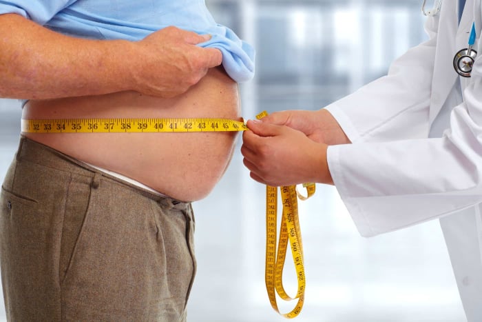 sindrom metabolik buncit obesitas