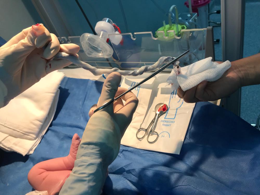 Bank Tali Pusat, Benarkah Berguna di Masa Depan?