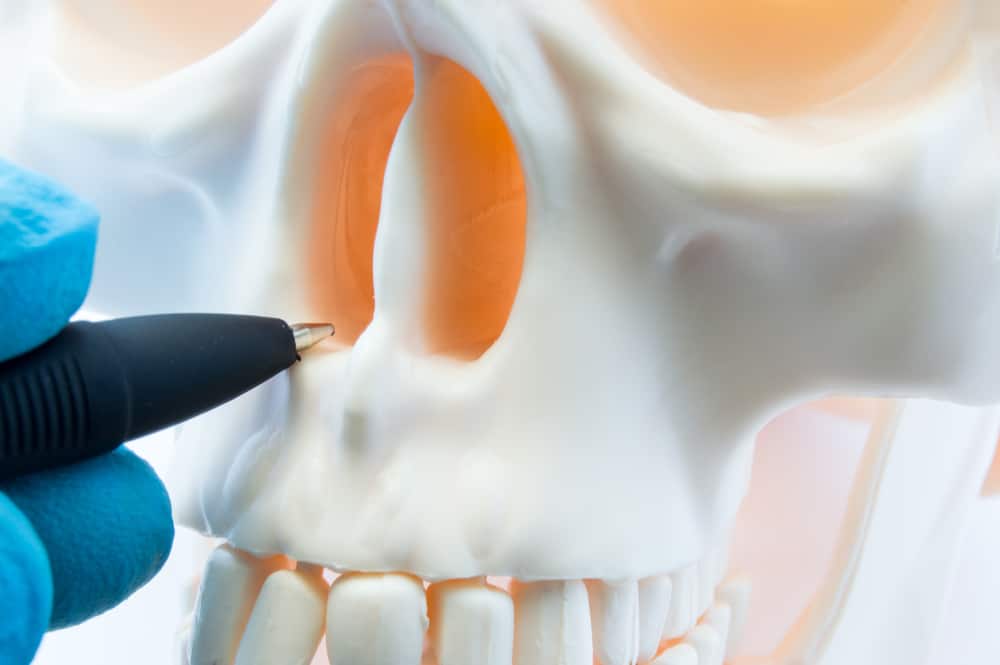 Apakah Lesi Tulang Berbahaya, dan Bagaimana Cara Mengatasinya?