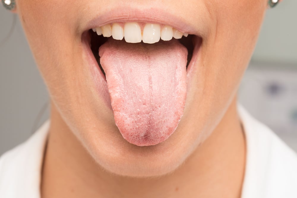 Cara menghilangkan rasa pahit di mulut saat demam