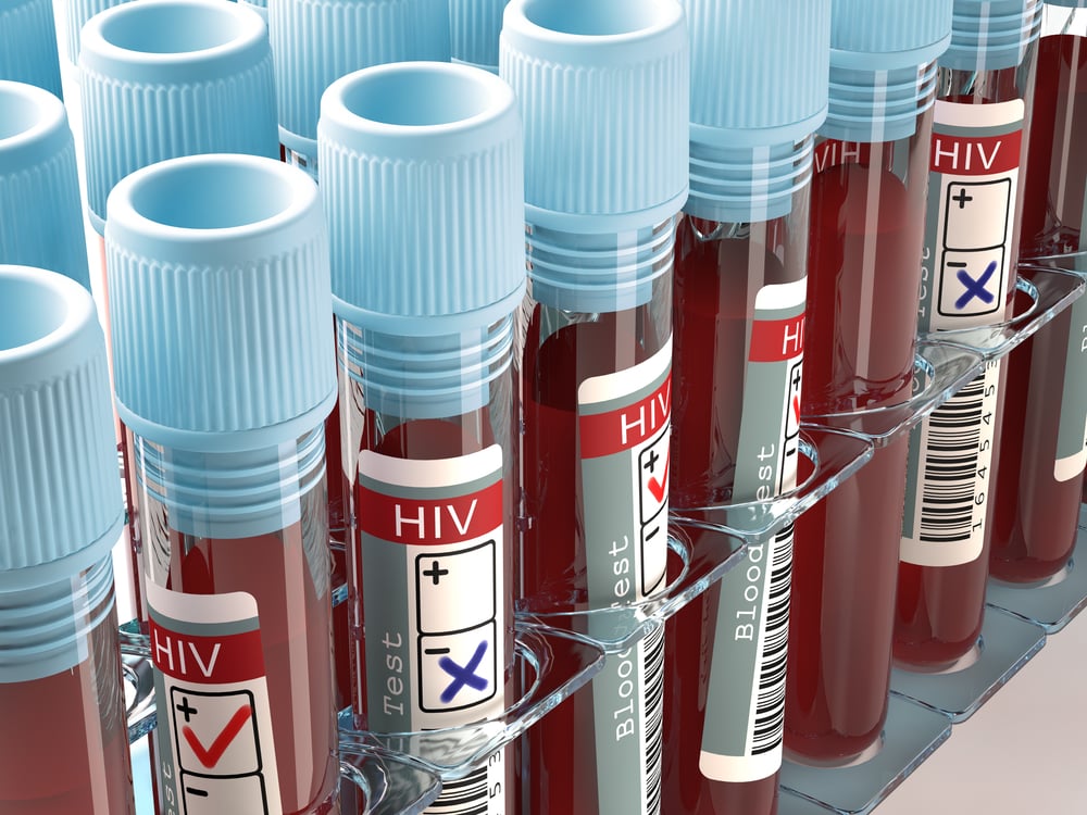 penularan HIV, virus HIV