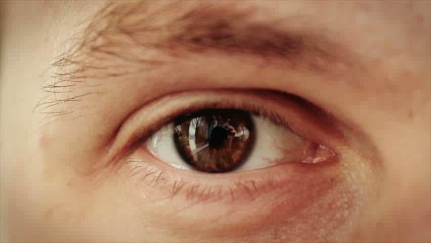 Berbagai Gejala Glaukoma yang Harus Anda Waspadai, Berdasarkan Jenisnya