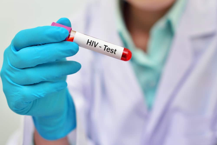 tes darah HIV