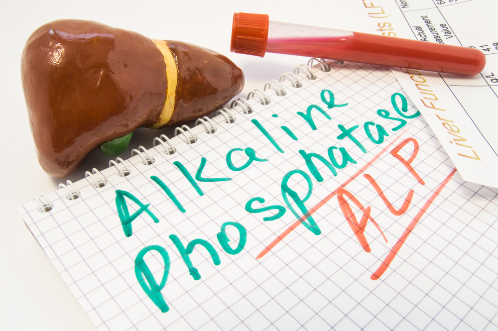 alkali-fosfatase-tinggi