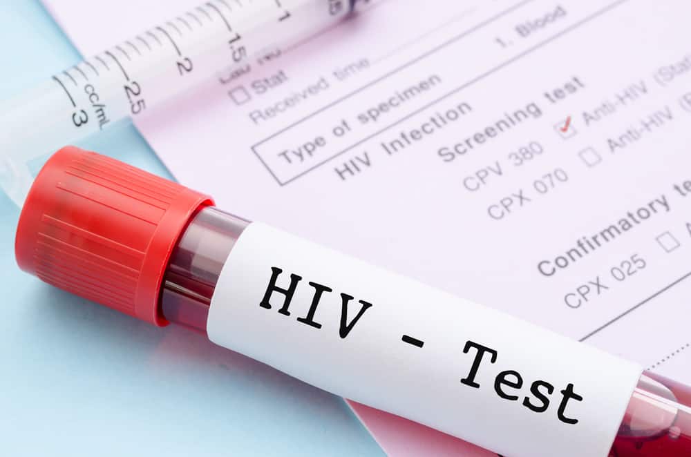 Seberapa penting melakukan tes HIV?