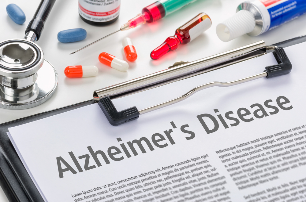 Kenali Obat dan Terapi untuk Mengobati Penyakit Alzheimer